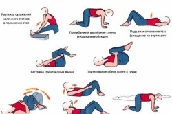 Комплекс упражнений при грыже поясничного отдела позвоночника