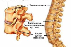 Схема остеохондроза поясничного отдела