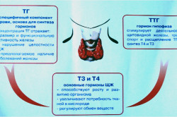 Медуллярный тип рака щитовидной железы