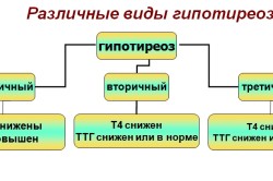 Виды гипотиреоза Виды гипотиреоза