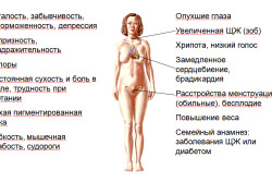 Признаки гипотиреоза