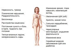 Проявления гипертиреоза
