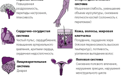 Симптомы гипертиреоза